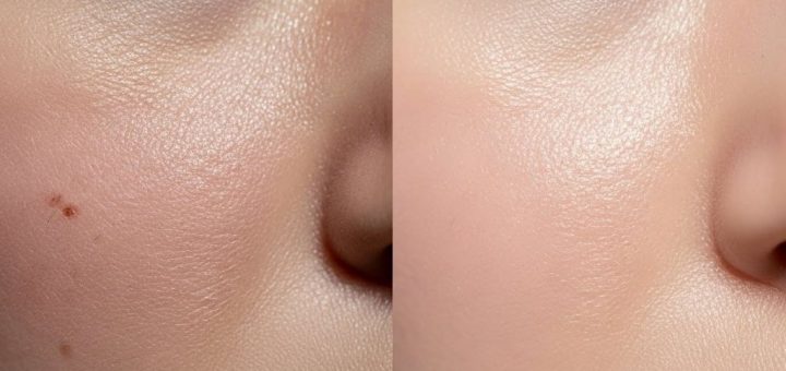 Close-up comparison of stressed dull skin versus healthy glowing skin showing visible texture differences